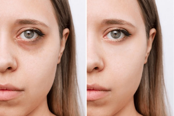 Best Full Coverage Concealer for Real Kiwi Skin Days