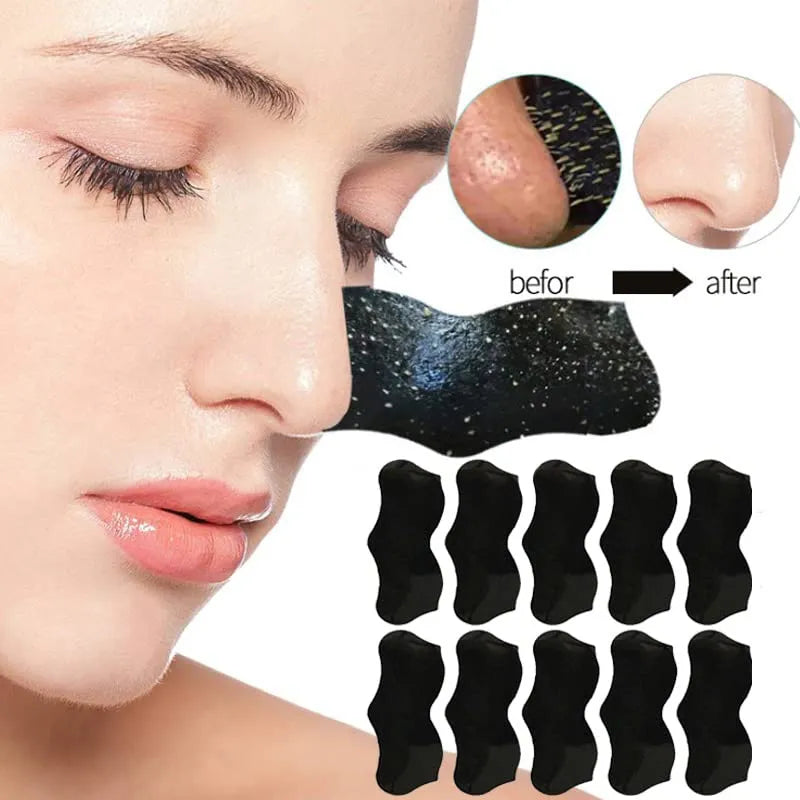 How to Get Rid of Blackheads: Kiwi Guide for Clear, Smooth Skin