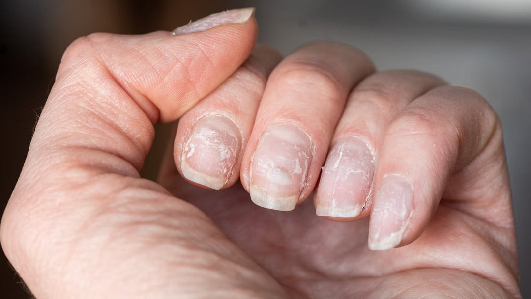 Anti-Breakage Nail Serum for Stronger and Healthier Nails