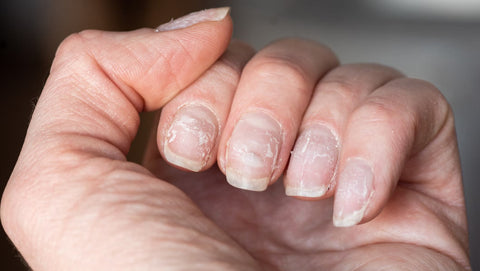Anti-Breakage Nail Serum for Stronger and Healthier Nails