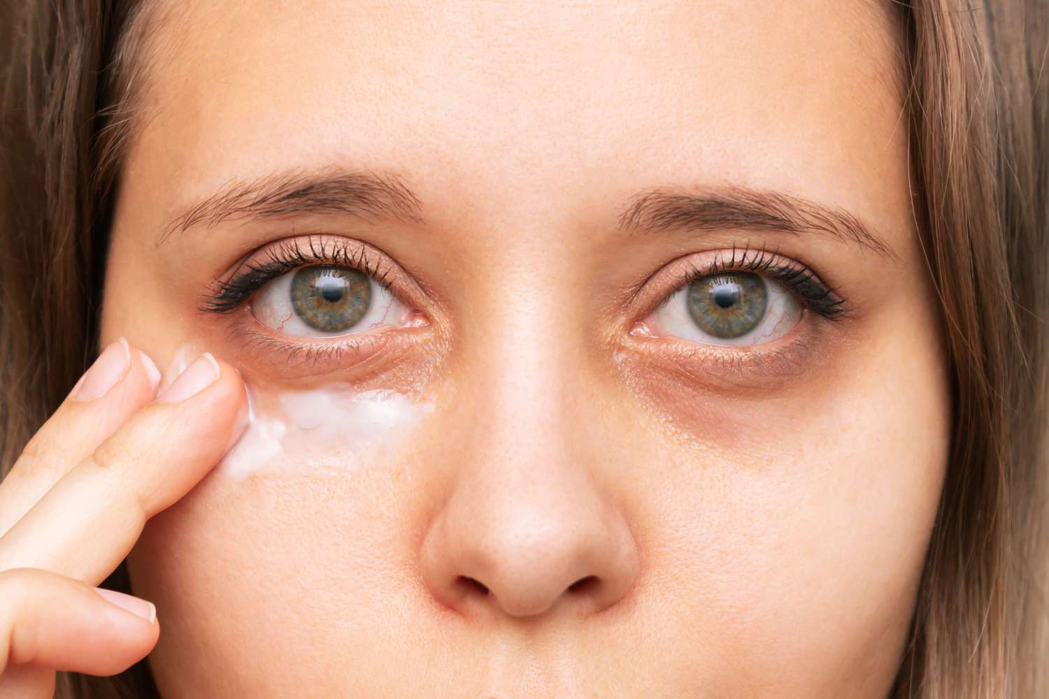 Best Under Eye Bags Treatment: Remedies and Routines for Refreshed Eyes