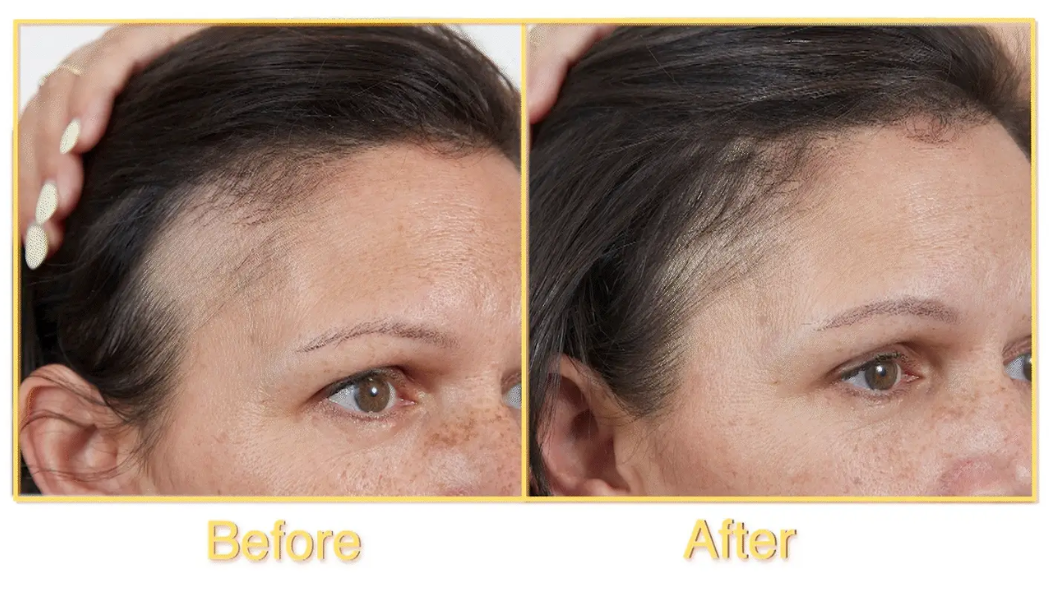 Everyday Habits That Are Quietly Ageing Your Skin