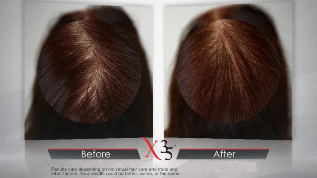 Thinning Hair Solutions for New Zealanders: What You Can Actually Do at Home