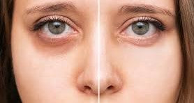 Best Skincare Routine for Dry Skin