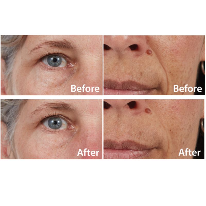 5in1 Facial Solution - Buy One Get One Free!