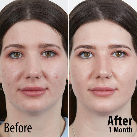 Caviar 3R at 50% OFF!