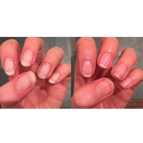 Pink Armor Nail Gel | Keratin Treatment For Long & Healthy Nails • Showcase